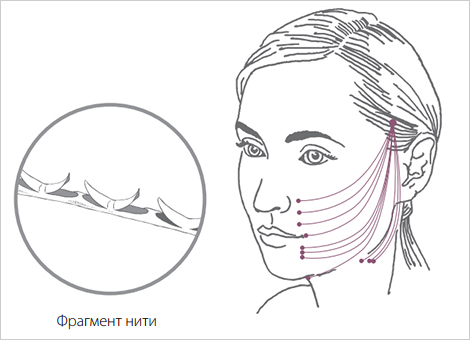 Нити Aptos Excellence Visage Нити Aptos Excellence Visage